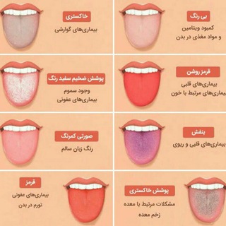 فروشگاه سلامت ضیایی (@forooshgahziyaei)